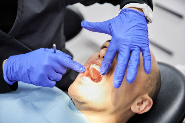 Best Emergency Dental Extractions in New Castle, IN